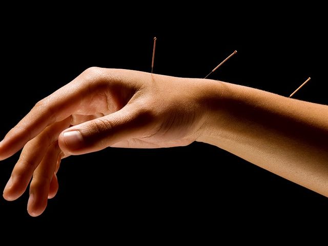 Photo of American College of Acupuncture and Oriental Med