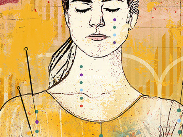 Photo of Acupuncture and Massage College